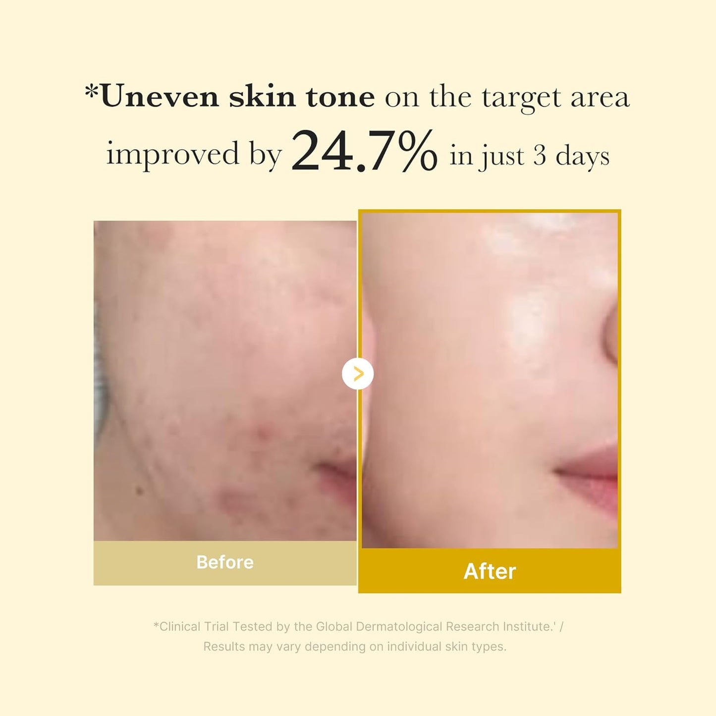 medicube Kojic Acid Turmeric Overnight Wrapping Peel Off Mask – Brightens & Defends Against Skin Stress for a Clear, Glowing Complexion, Korean Skincare, 2.53 fl. oz.